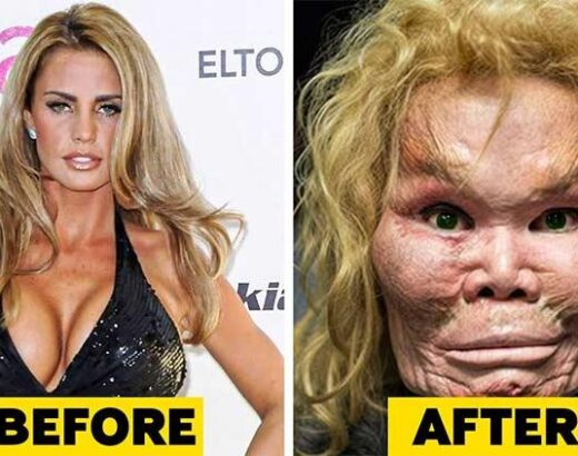 Makeovers darkside: 20 celebrity plastic surgery disasters
